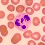 Neutrofilci predstavljajo večino leukocitov (50-70 %) ne barvajo se s kislimi ali bazičnimi barvili imajo segmentirano jedro, polimorfonuklearni leukociti ali PMN citoplazma je polna lizosomov so