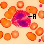 Eozinofilci barvajo se s kislimi barvili predstavljajo 2-5 % vseh leukocitov napadajo objekte, ki so označeni s protitelesi fagocitirajo