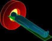 (Positron Emission Tomography) Izsevana 2 fotona - kolimacija ni potrebna Dobra prostorska ločljivost (do 2 mm) Visoka