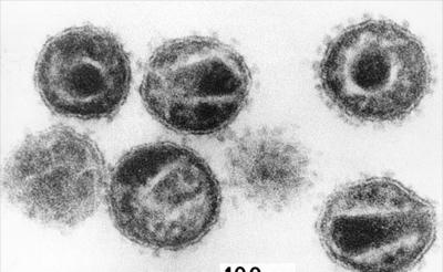 Human Immunodeficiency Virus Ιός της ανθρώπινης ανοσοανεπάρκειας (HIV) Ιοί Μέγιστο Μέγεθος (nm).. 120 Κρούσµατα ανά έτος.. 2.000.000 Επικινδυνότητα (σχετ.). 19 O ιός HIV προκαλεί τη νόσο του AIDS.