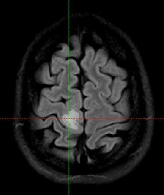 Eye, Histogram Analysis Plugin, FORTH NPAP,