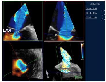 jacc Cardiovasc Imaging 2012;5:669 676 -Thavendiranathan P, et al.