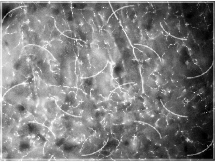6 * KONTROLA MD 5 GUSTINA TH+ (10 3 /mm 3 ) 4 3 2 1 0 NC.ACCUMBENS Графикон 20. Густина TH+ влакана у nucleus accumbens-у код контролних и матернално депривираних животиња.