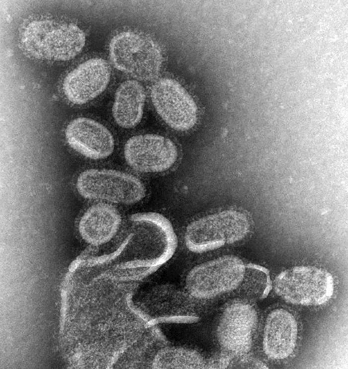 H ΠΑΝΔΗΜΙΑ ΤΟΥ 1918: H ΙΣΠΑΝΙΚΗ ΓΡΙΠΗ Χαρακτηρίστηκε από ένα ασυνήθιστα λοιμογόνο στέλεχος ιού γρίπης (Η1Ν1) Έλαβε χώρα σε 3 διαφορετικά κύματα προκαλώντας το θάνατο συνολικά 40,000,000 ανθρώπους (>