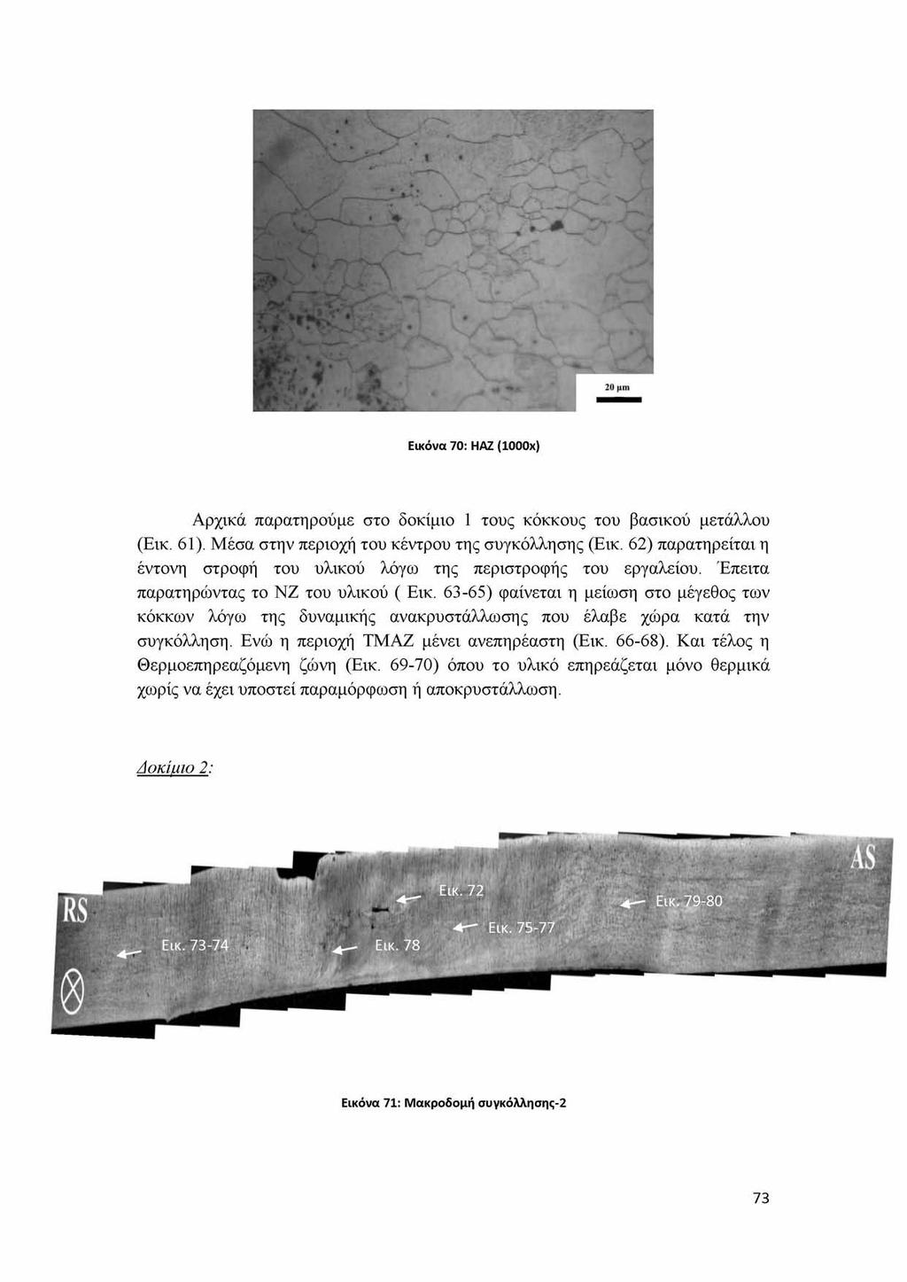 Εικόνα 70: ΗΑΖ (1000x) Αρχικά παρατηρούμε στο δοκίμιο 1 τους κόκκους του βασικού μετάλλου (Εικ. 61). Μέσα στην περιοχή του κέντρου της συγκόλλησης (Εικ.