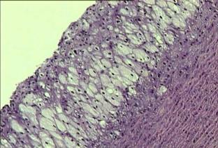 C, et al In vivo antiatherogenic properties of olive oil