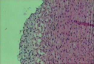 rabbits., Nutr Metab Cardiovasc Dis.