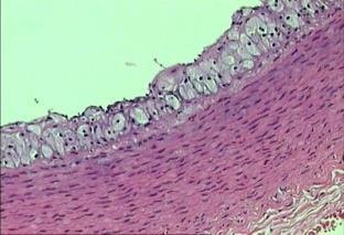 Atherosclerosis regression study in rabbits upon olive