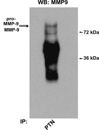 Οι ζελατινάσες MMP-2 και ΜΜP-9 αλληλεπιδρούν άμεσα με την ΡΤΝ αλλά όχι με τη midkine σε ενδοθηλιακά κύτταρα HUVEC Ελέγχθηκε η αλληλεπίδραση της ΡΤΝ με τις ζελατινάσες MMP-2 και MMP- 9 και σε