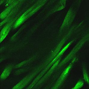 Control Cutinase Control NaOH איור 47 צילום במיקרוסקופ קונפוקלי של קישור CBD-GFP לסריגי כותנה מטופלים בקוטינאז )