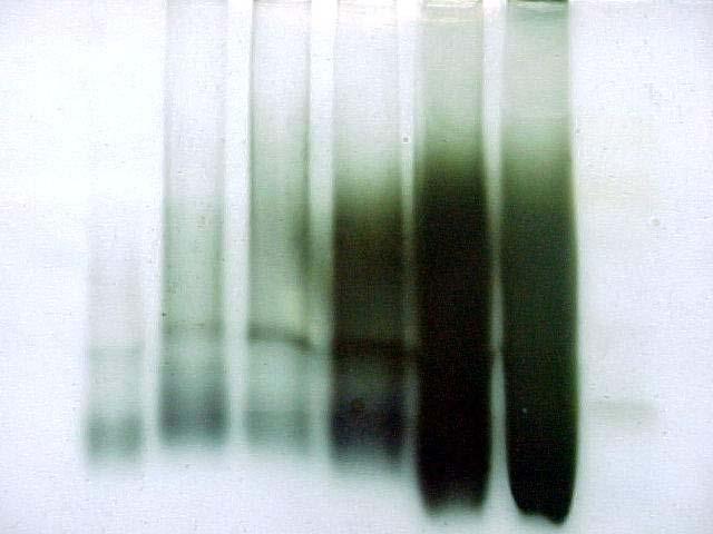 צב יעת חלבון פע יל ותאסתרא ז ות Mono Q ph 9 21 Mono Q ph 8 Superdexx Crude 19-20 11 10 13-16 סמן IEF pi 4.45-9.6 Mono Q ph 9 21 (MW kd) pi (31) 6 (18.4) 5.1 (23.2) 4.