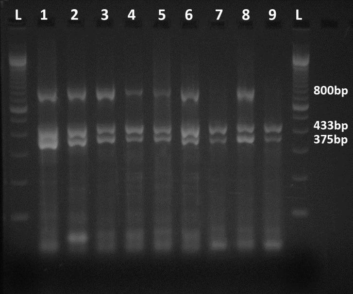 ΔΗΜΟΣΙΕΥΣΕΙΣ Figure 1. Agarose gel electrophoresis of Multiplex RT-PCR products. Lanes 1-9 reference strains Echo1, Echo2, Echo3, CBV1, CBV2, CBV3, CAV1, CAV9 and CAV11 respectively.