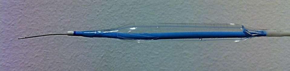 The injection catheter: Distal part Side holes Outer balloon Inner balloon Side holes The