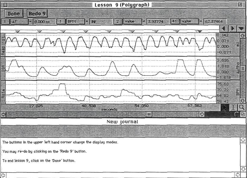 88 Lucrări practice de fiziologie 3. Se selectează Lesson 9 (Poligraphy). Se introduce numele. 4. Pentru înregistrare subiectul stă aşezat pe scaun, cât mai relaxat.