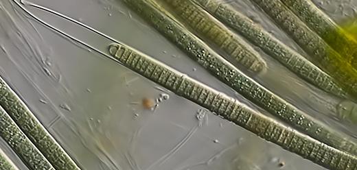 filament trihom obavijen sarom
