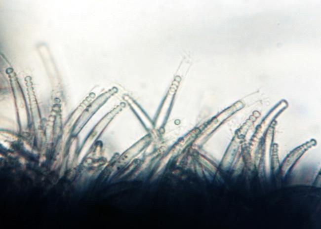 egzospore Chamaesiphon sp.