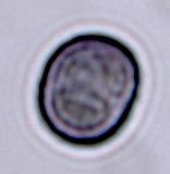 zaštita od parazita i