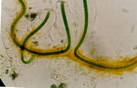 Anabaena sp.