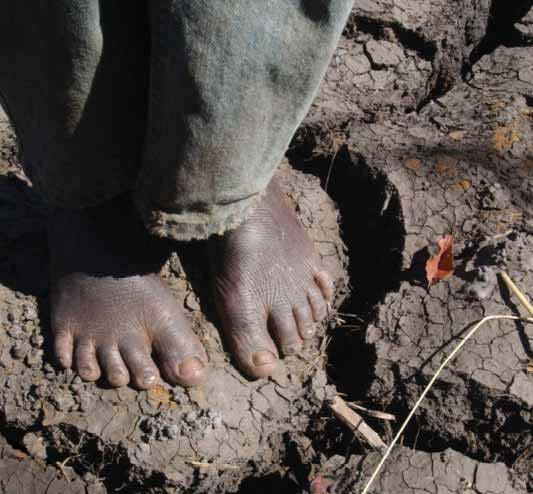 Si rrjedhojë e pozitës gjeografike dhe varfërisë, Afrika ka pësuar një ndryshim të madh dhe të shpërpjestuar për zona të ndryshme nga ngrohja globale.