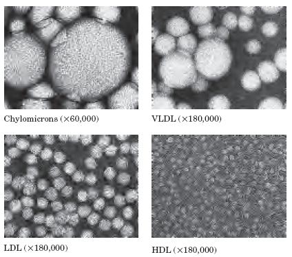 Lipoproteini so nadmolekulski kompleksi lipidov in proteinov 4