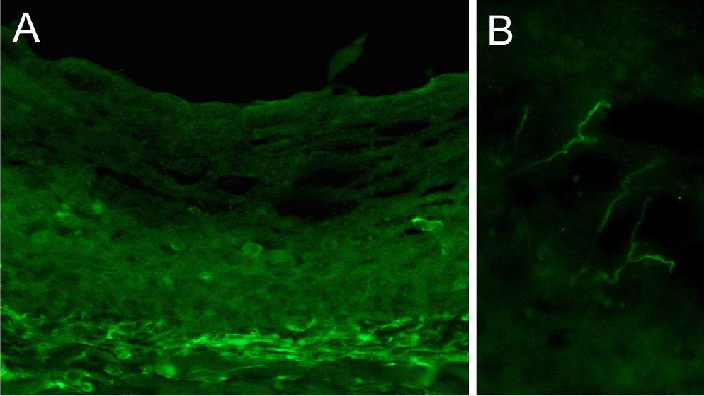 Basal urothelium