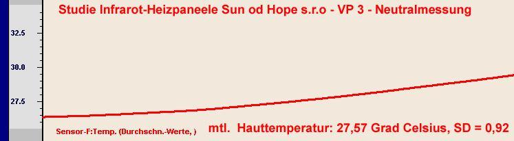 Všetky testované osoby vnímali teplo z infračervených vykurovacích panelov firmy Sun of Hope sro príjemne. Vývoj teploty kože je podrobne znázornený v nasledujúcej tabuľke.