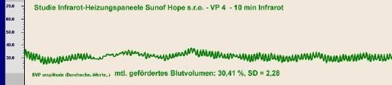 = 2,28 Amplituda BVP (priemerné Priemerné hodnoty) namerané hodnoty Průměrné prekrvenia prokrvení: (%) 24,42%, SD = 1,48 Časový úsek 2: Stav po10 minútach aktívneho infračerveného žiarenie Štúdia