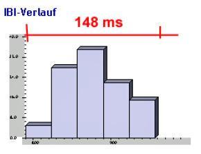 Nameraná hodnota Časový úsek 3: stav po 20 minutách aktivního infračerveného žiarenie Priebeh IBI 148 ms Vedľa zníženia výkonu kardiovaskulárneho systému o 18% u testovanej osoby VP 6 možno na