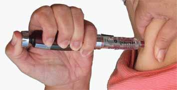 Në këto 25 vjetët e fundit aget me gjatësi nga 16 mm (1.6 cm.) po përdoren 4-8 mm, madje më të ngushta se më parë dhe janë thuajse të padhimbshme.