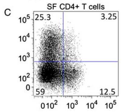 ΡΑ: GM-CSF+ T λεµφοκύτταρα Ο GM-CSF -Παράγεται κυρίως από αρθρικούς