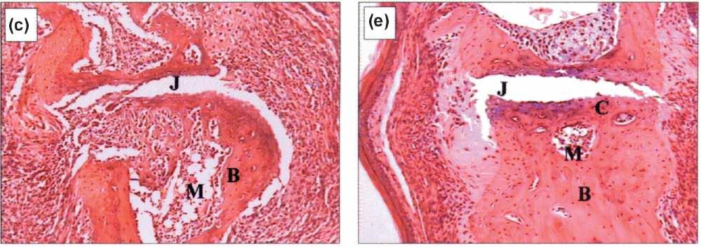 GM-CSF: Ζωικά µοντέλα αρθρίτιδας Επιδείνωση της προκαλούµενης από Collagen-induced arthritis (CIA) κολλαγόνο αρθρίτιδας µε GM-CSF 1 Αναστολή ή βελτίωση της αρθρίτιδας - Collagen Induced Athritis 2 -