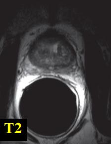 Advancements in MR imaging of the prostate: from diagnosis to