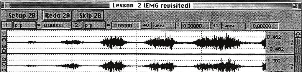Electromiografia 69 16. Click pe butonul Record 2A. Va urma o înregistrare de 30 sec.