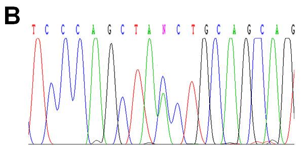 php OMIM (Online Mendelian Inheritance in Man) Naloga - sekvenciranje Določite sekvenco matrične DNA po obeh metodah sekvenciranja (od 5` do 3`konca)!