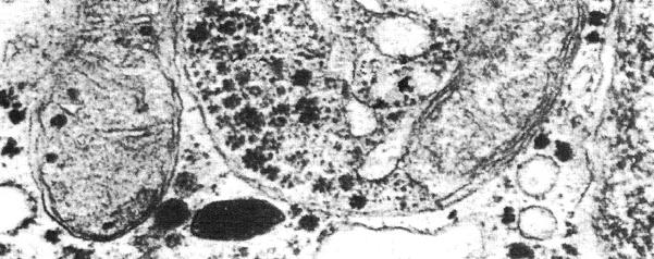 mitohondrija u