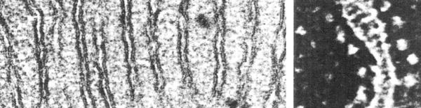 granule u matriksu - grepr - ribozomi
