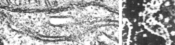 mitohondrije   granule u matriksu - grepr -