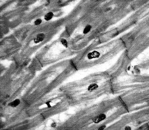 Srčano mišićno tkivo - srčana radna mišićna ćelija - nukleus srčane radne mišićne ćelije - interkalarni diskovi - oblast citoplazme sa organelama uključenim u sintetske procese - oblast