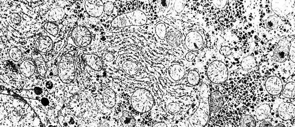 ribozomima - nukleoid Životinjska