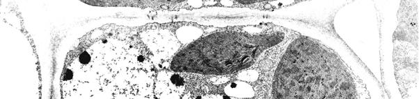 Biljna ćelija ćelija lista - ćelijski zid - primarna lamela - plazmodezme - ćelijska membrana - vakuole - hloroplast - mitohondrija - peroksizom Proširite znanje Escherichia