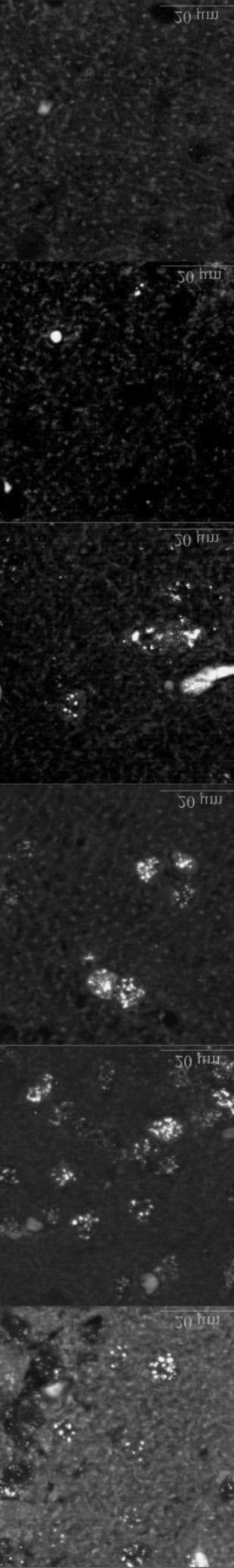 μ ³ μ -Ô² ³ Í Ö γh2ax 53BP1 Ëμ±Ê μ ³μ² ±Ê²Ö μ μ ²μÖ