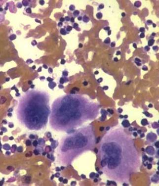 cytoplazmy z megakaryocytov prežívanie v krvi: 9 12 dní diskovitý tvar v