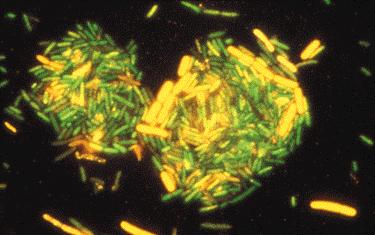 Fluorofori za G+ in G- bakterije