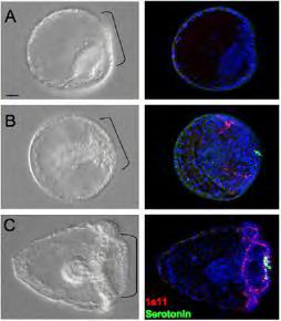 Εικόνα 18: (Α,Β) Έμβρυα 3 ημερών,ενεμένα με δύο διαφορετικά Six3 morpholinos, που δίνουν ισχυρό φαινότυπο με πλήρη απώλεια νευρικών κυττάρων και πιο