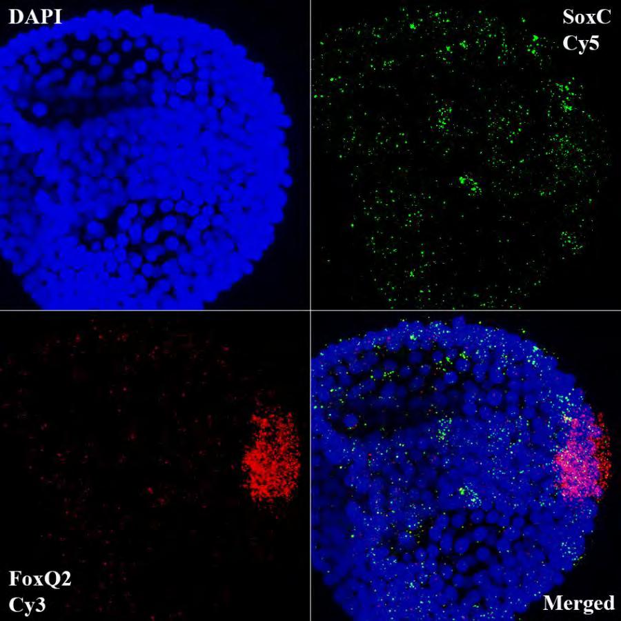 Εικόνα 55: Συνεντοπισμός SoxC-FoxQ2 σε έμβρυα αχινού στο στάδιο του γαστριδίου. Με μπλε χρώμα απεικονίζονται οι πυρήνες των κυττάρων, με κόκκινο το FoxQ2 και με πράσινο το SoxC.