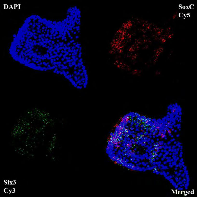 Με μπλε χρώμα απεικονίζονται οι πυρήνες των κυττάρων, με κόκκινο το