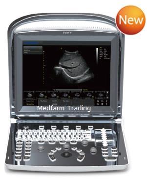 ECOGRAFE Ecografe digitale - Chison Medical Imaging/China http:///aparatura-medicala/produse/subcategoria-ecografe-198/ Ecograf digital ECO1 APLICATII: Abdomen,Obstetrica& Ginecologie, Urologie,