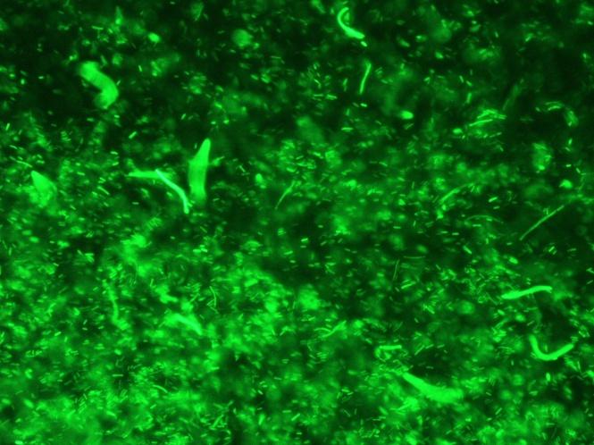 Κεφάλαιο 4 Αποτελέσµατα Εικόνα 4.9 GFP+ κύτταρα E. coli DH5a που περιέχουν το πλασµίδιο pad43-25 κάτω από µικροσκόπιο φθορισµού.