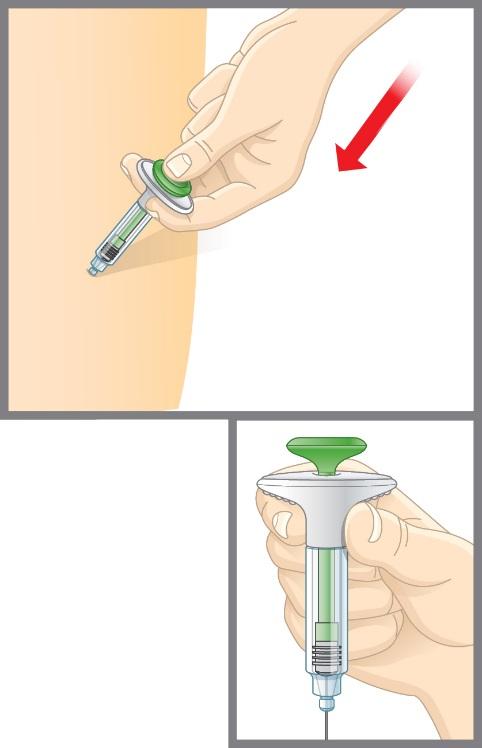 2δ Ωθήστε το έμβολο προς τα μέσα. Πιέστε αργά το έμβολο έως το τέλος της διαδρομής του, μέχρι να ολοκληρωθεί η ένεση ολόκληρης της ποσότητας του φαρμάκου.