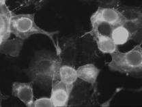 Ευκαρυωτικά κύτταρα (καλλιέργεια) Κυτταροπαθογόνο φαινόμενο ανοσοφθορισμός Καλλιέργεια των